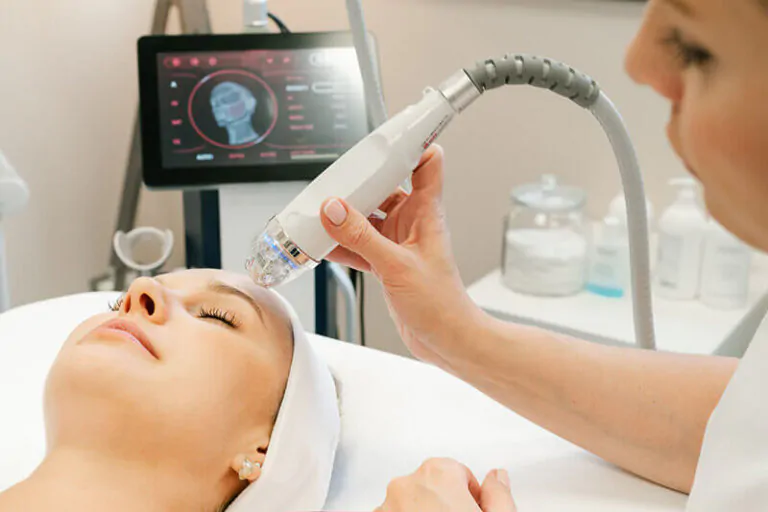 Radiorefractive Micro ac Rf Lifting fără bisturiu